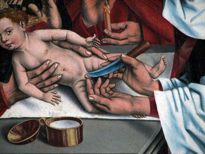 Herlin, Beschneidung Jesu, 1466